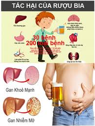 TRỂN KHAI THỰC HIỆN CÔNG ĐIỆN SỐ 488/CĐ-TTG  VỀ VIỆC CHẤP HÀNH QUY ĐỊNH VỀ PHÒNG, CHỐNG TÁC HẠI CỦA RƯỢU, BIA